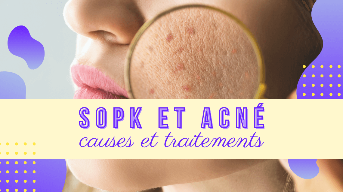 SOPK et acné : causes et traitements - Ma Vie Après